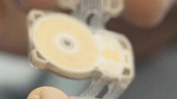 Implantan los primeros chips contra la apnea del sueño controlados desde una aplicación