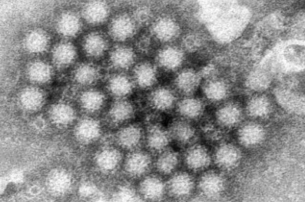 El norovirus regresa con fuerza y los casos en Estados Unidos aumentan notablemente