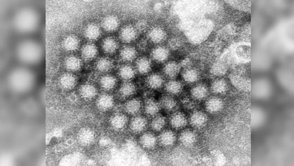 Aumentan en EU los brotes de un virus estomacal que causa vómitos y diarrea súbitos