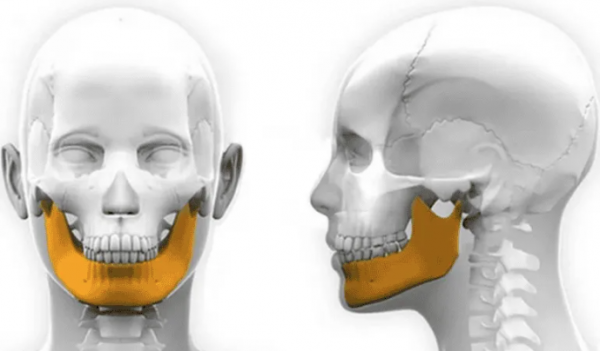 Científicos crean implante de mandíbula humana en una impresora 3D